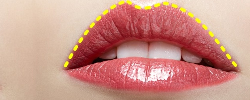 Labios caídos
