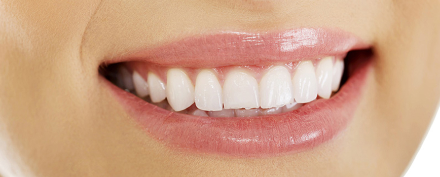 Labios "normales"