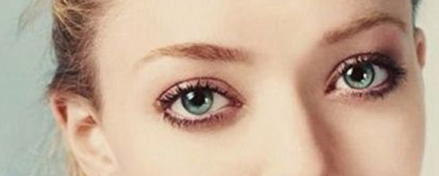 Saltones: uno de los tipos de ojos más peculiares