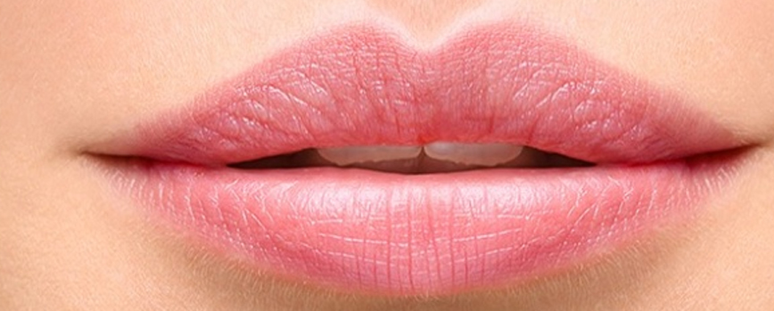 Labio superior grueso