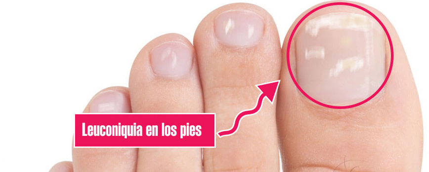 Cómo blanquear las uñas de los pies  7 pasos