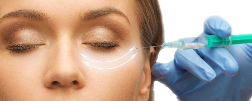 Quitar las ojeras con ácido hialurónico