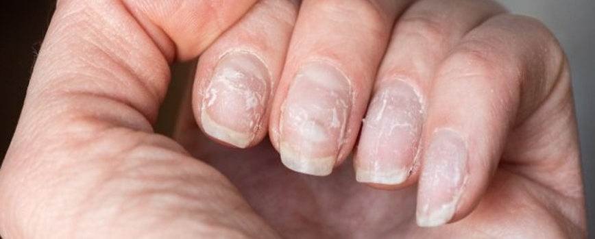 Lo que tus uñas revelan sobre tu salud y no sabes