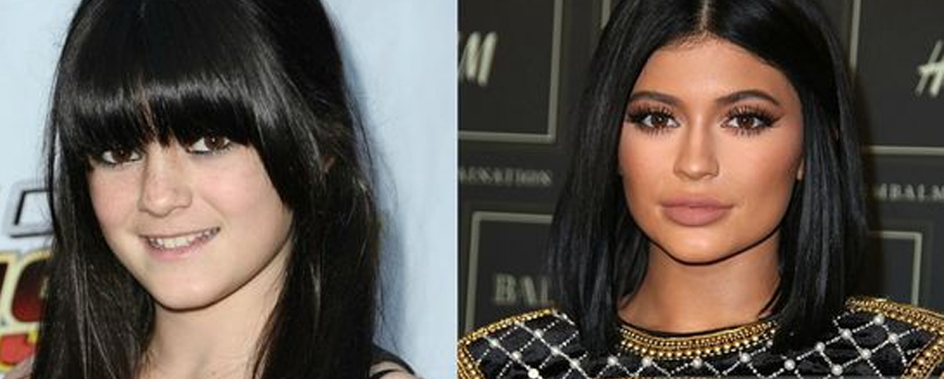 ¿Qué es un glow up?