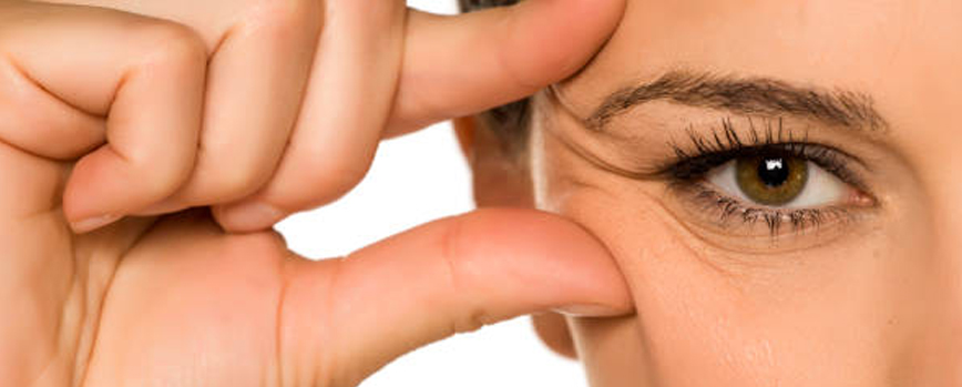 Cómo eliminar las líneas de expresión de los ojos