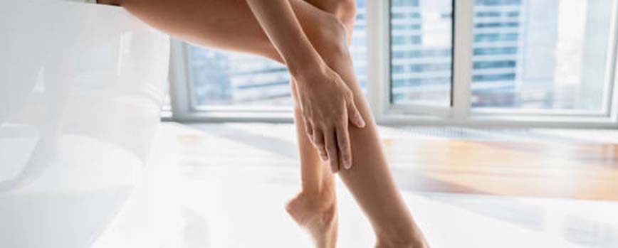 Varices en las piernas