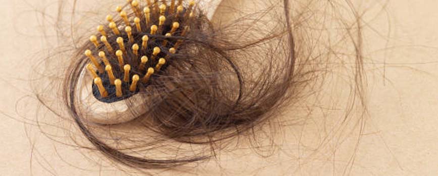 Alopecia