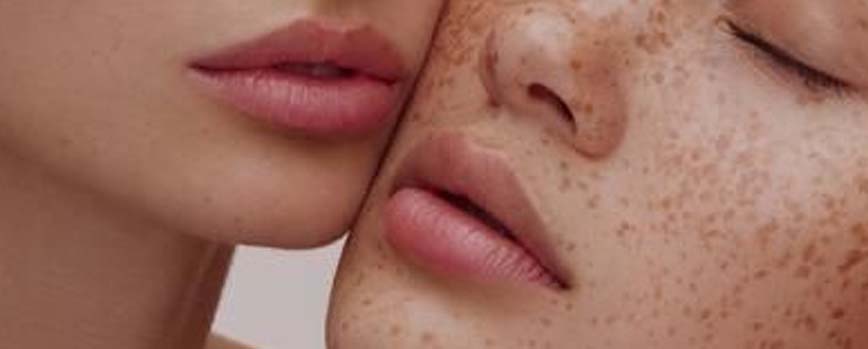 ¿Qué ventajas tiene la micropigmentación de labios?
