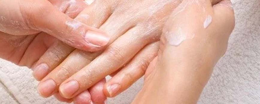 ¿Cómo prevenir los sabañones?