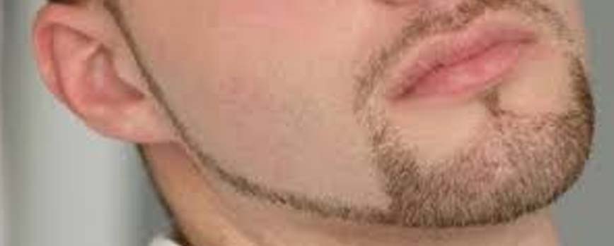 Barba de ancla