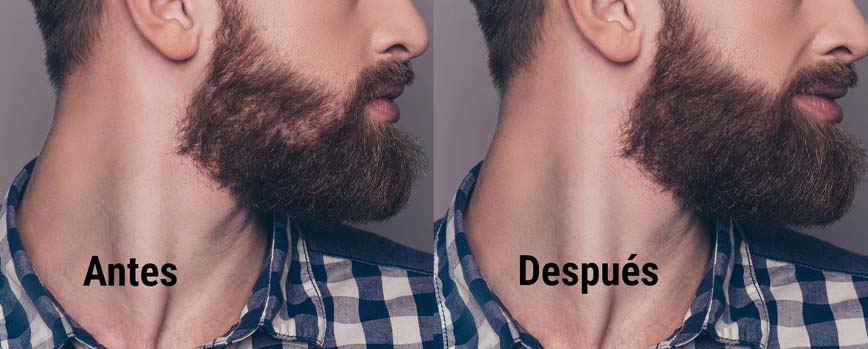¿Por qué llevar la barba perfilada?