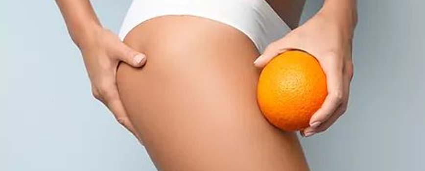 Antes de nada, ¿qué es la piel de naranja?