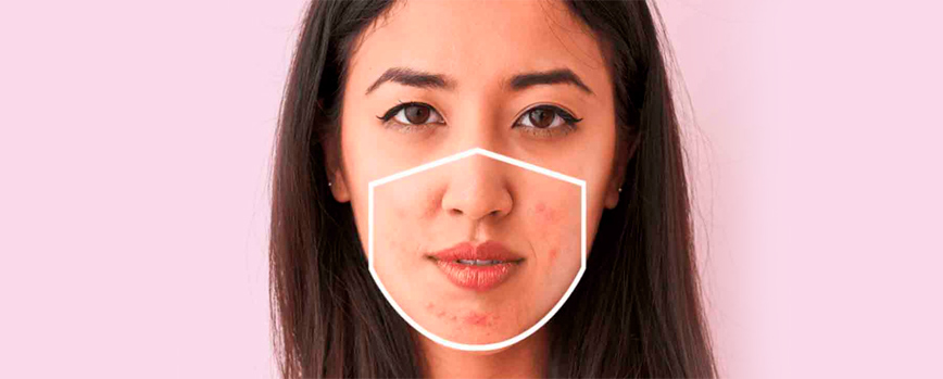 Antes de nada, ¿Qué es el maskné?