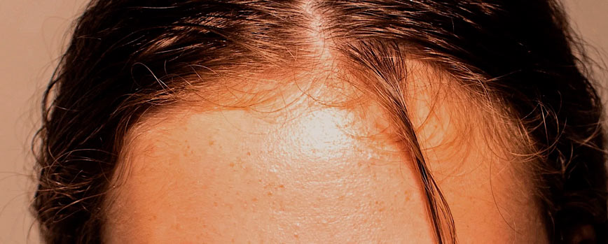 ¿Qué son los baby hairs?