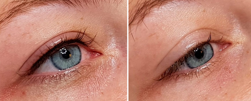 Eyeliner permanente: ¿cómo funciona?