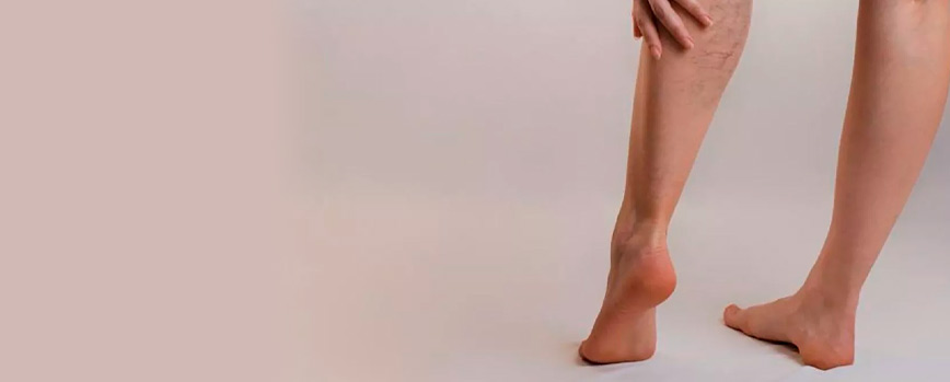 ¿Eres propenso a las venas varicosas? ¡Prueba la caléndula!