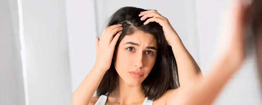 ¿Cómo prevenir la dermatitis seborreica?