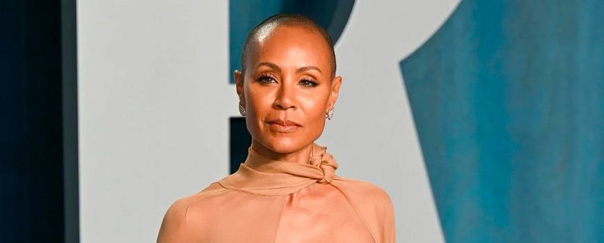 ¿Qué es la alopecia areata?