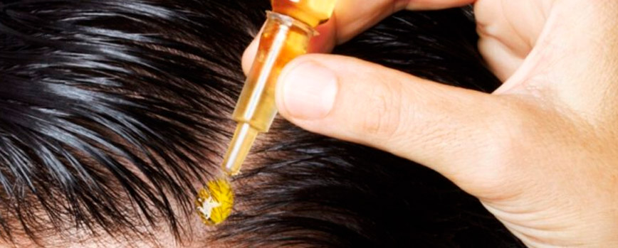 Productos capilares con minoxidil y zinc