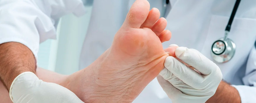 ¿Cómo prevenir los hongos?