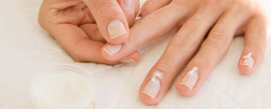 ¿Cómo tratar las uñas naturales después de haber retirado las uñas de gel?