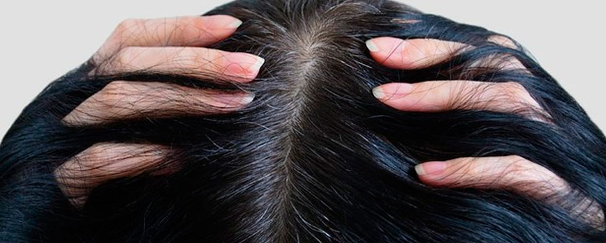 ¿Qué causa las canas?