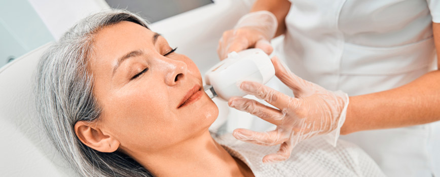 Tratamientos para eliminar las arañas vasculares en la cara
