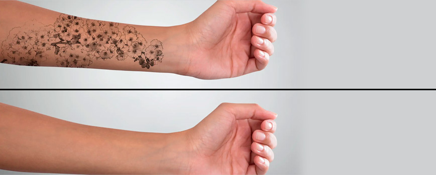 Maquillaje que tape tatuajes: ¿Qué color escoger?