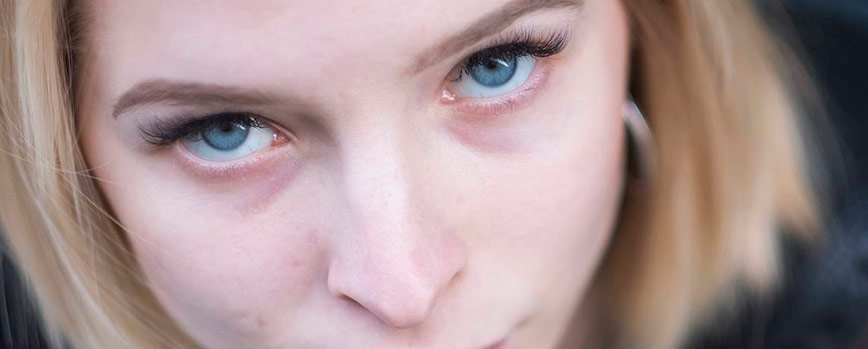 ¿Qué son las ojeras moradas?