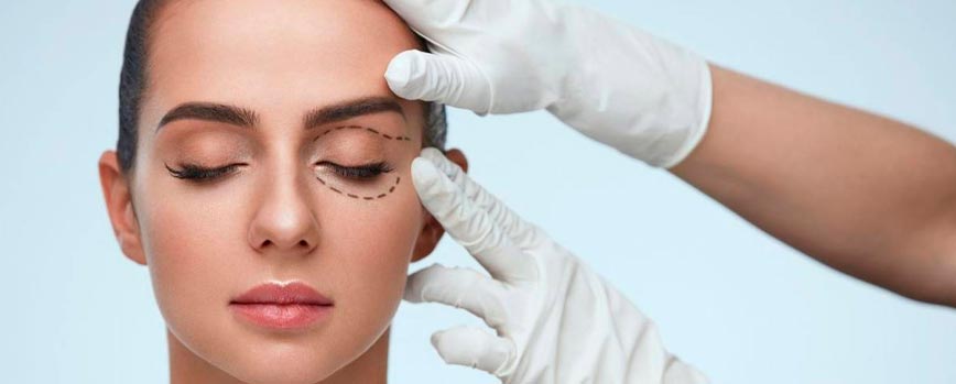 ¿En qué consiste la blefaroplastia sin cirugía?
