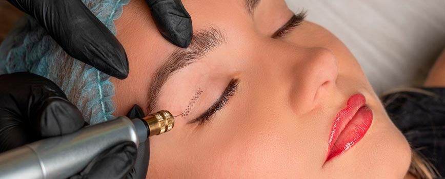 ¿Cómo se lleva a cabo la blefaroplastia sin cirugía y cuándo dura?