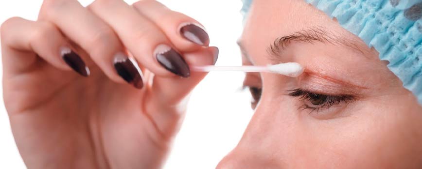 Otros cuidados a tener en cuenta después de una blefaroplastia