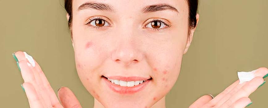 ¿Por qué utilizar una crema para los granos farmacia?