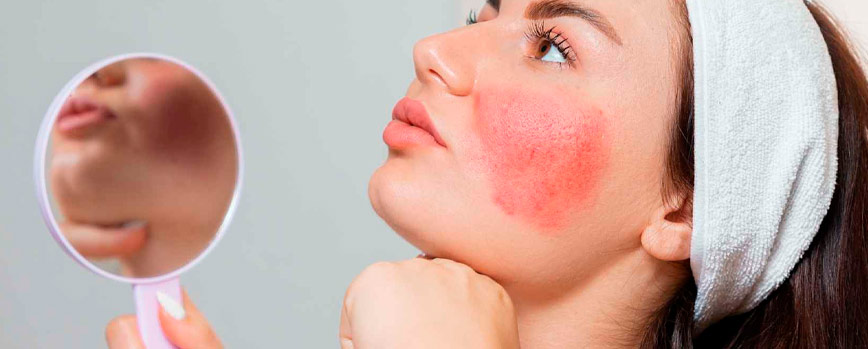 Alergia a los cosméticos