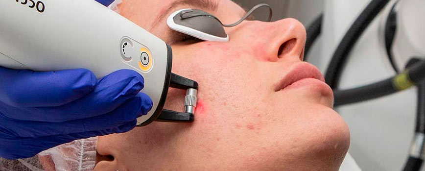Laserterapia: