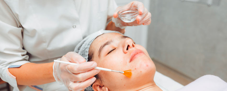 ¿Qué es un exfoliante químico?