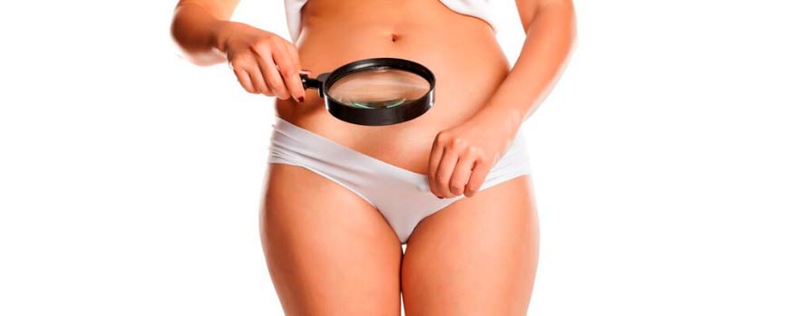 Causas del oscurecimiento de la zona íntima femenina