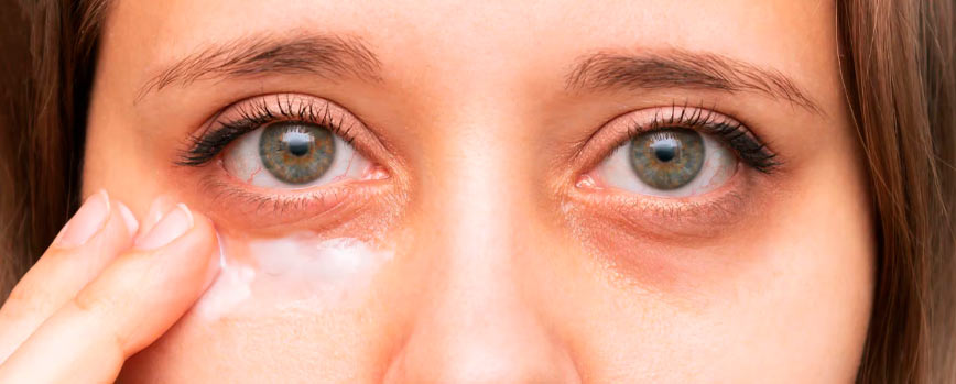 Tratamiento de las ojeras pigmentadas