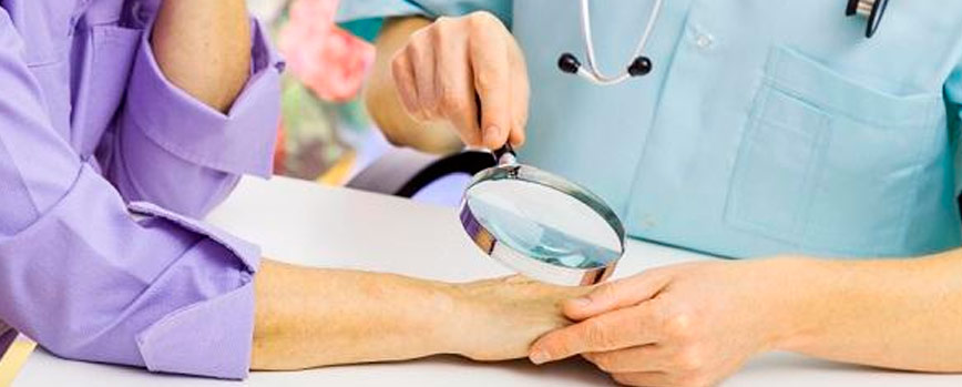 ¿Cuándo se debe recurrir al médico por el picor en las manos?