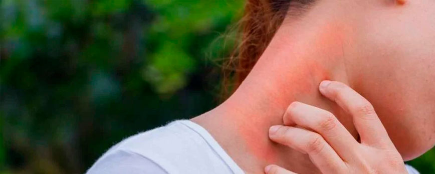Principales causas del picor en el cuello