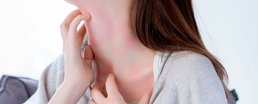 ¿Cómo aliviar el picor del cuello?