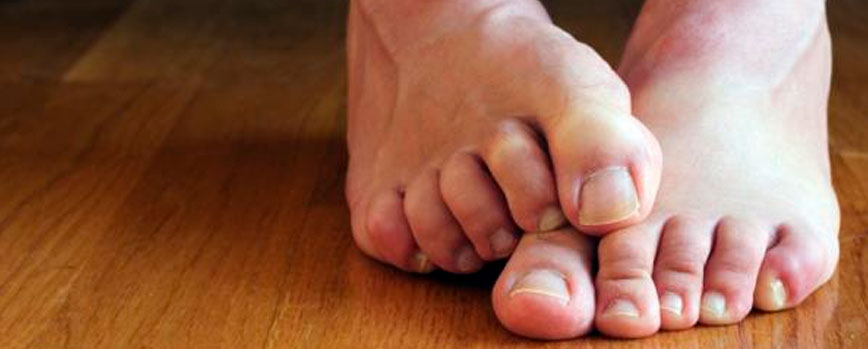 Antes de nada, ¿a qué puede deberse el picor en los pies?