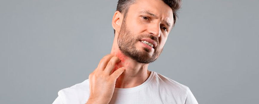 Sarpullido en el cuello: ¿qué es y por qué aparece?