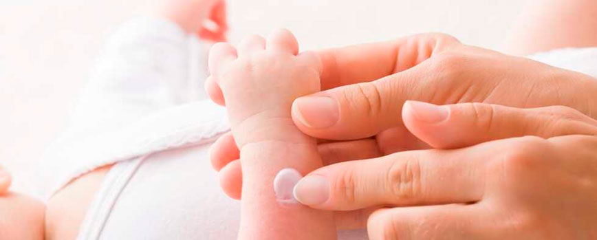 Cómo quitar el sarpullido en bebés