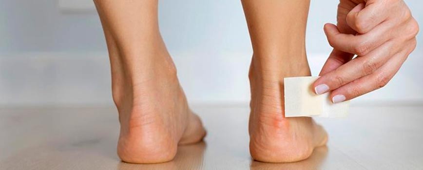 Cómo curar ampollas en los pies en solo 5 pasos