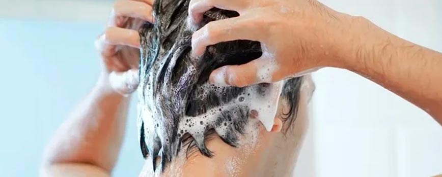 Consejos para el tratamiento de la psoriasis en el cuero cabelludo