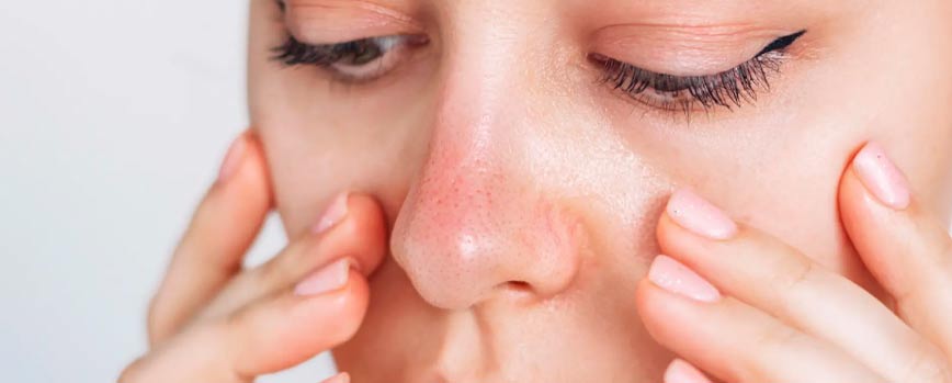Causas de la psoriasis en la cara