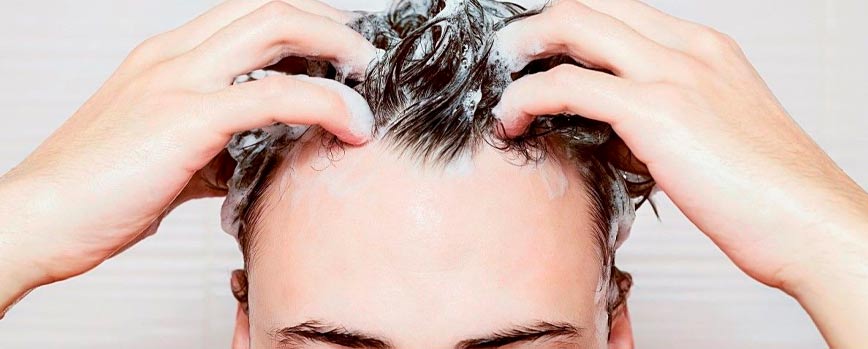 ¿Cómo prevenir la dermatitis seborreica en el cuero cabelludo?