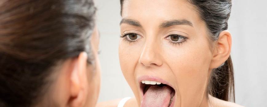Evita la aparición de llagas en el paladar: 5 tips esenciales para prevenirlas