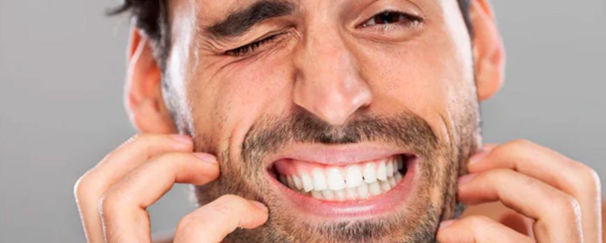 Síntomas de la dermatitis seborreica en la barba